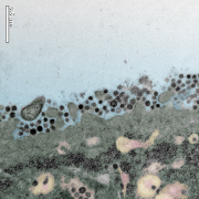 An electron microscope picture shows that the cells from human bronchial tissue can be infected by MERS-CoV and the MERS-CoV can replicate in human respiratory tissues.